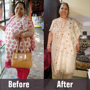 A successfully treated patient at Famicare Speciality Centre, Rohini, Delhi.